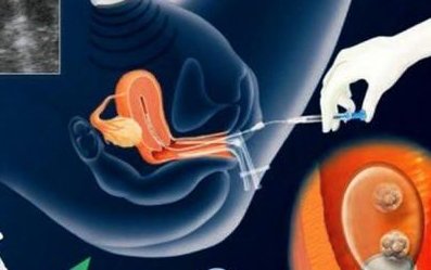 衢州三代试管婴儿十佳院校！哪些医院不用排队？