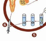 没有输卵管没排卵可以做试管？