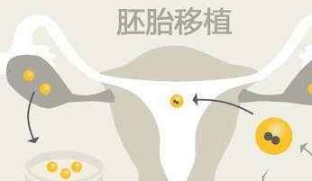 染色体易位在山东中医药大学第二附属医院可以做三代试管吗？染色体平衡易位还能生健康的宝宝吗？