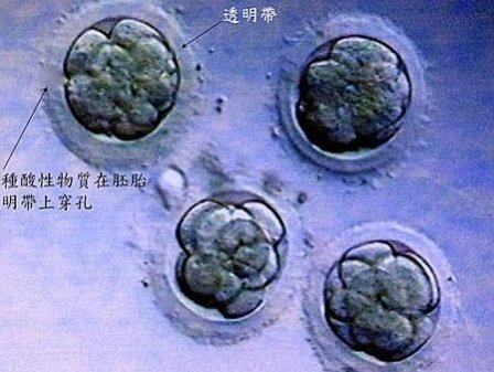 常州市妇幼保健院试管婴儿新突破 成功率破55%